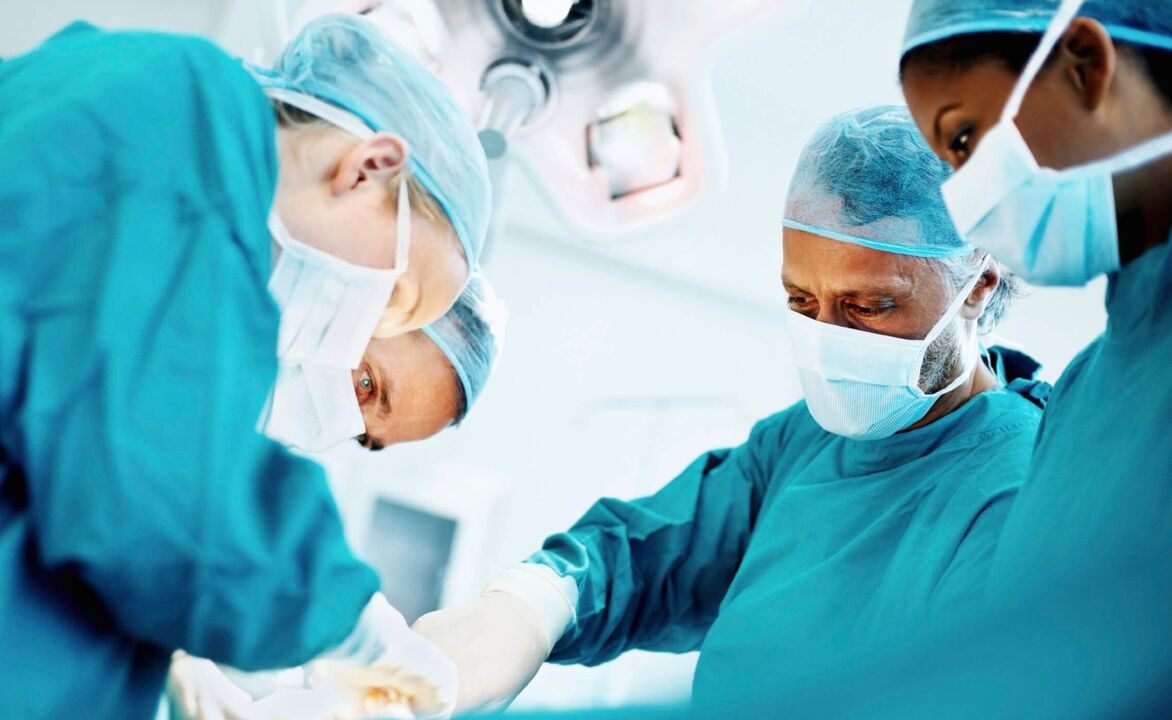Процес збільшення члена хірургами через проведення операції
